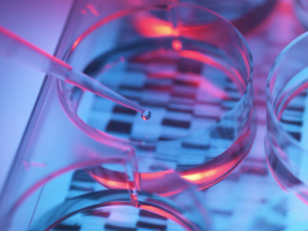 Pipetting sample into tray for DNA testing